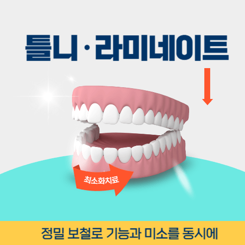 김천치과 김천시 치과 틀니 라미네이트