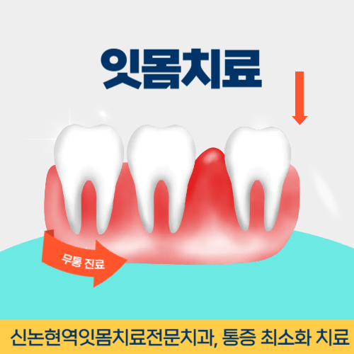 김천치과 김천시 치과 잇몸치료